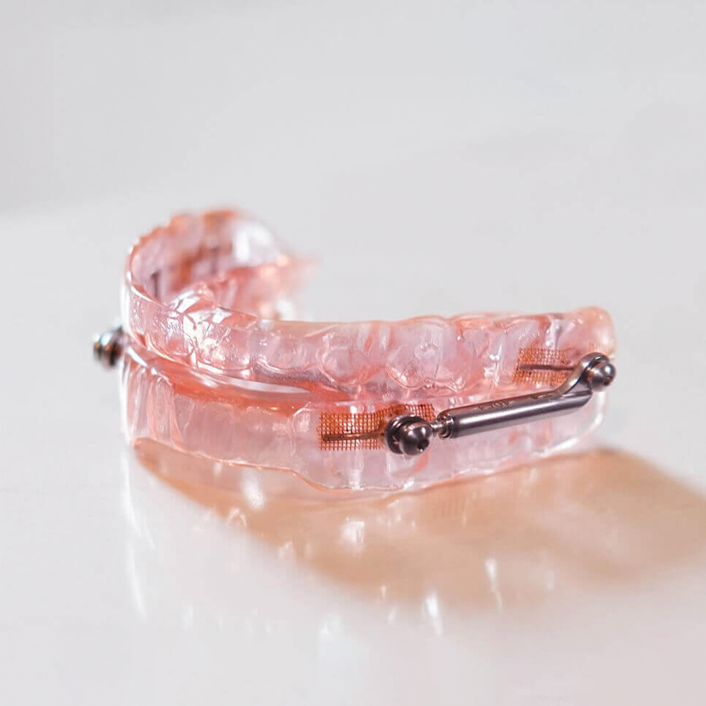 SomnoDent solution for sleep apnea - Dream Sleep Center Big Pine Key Florida